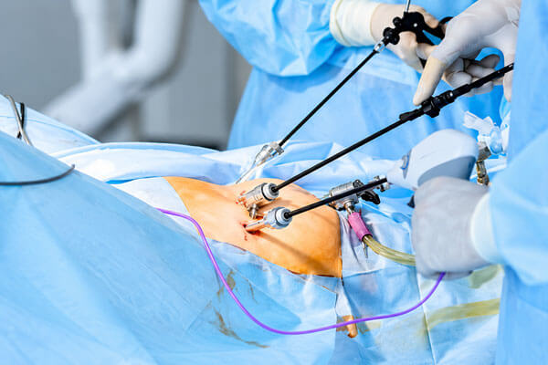 Laparoscopic Cancer Surgeon in Mahim