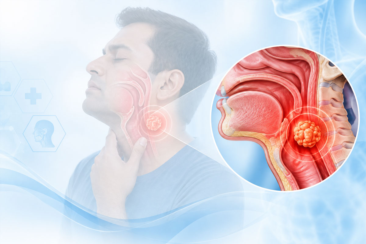 Head and Neck Cancer