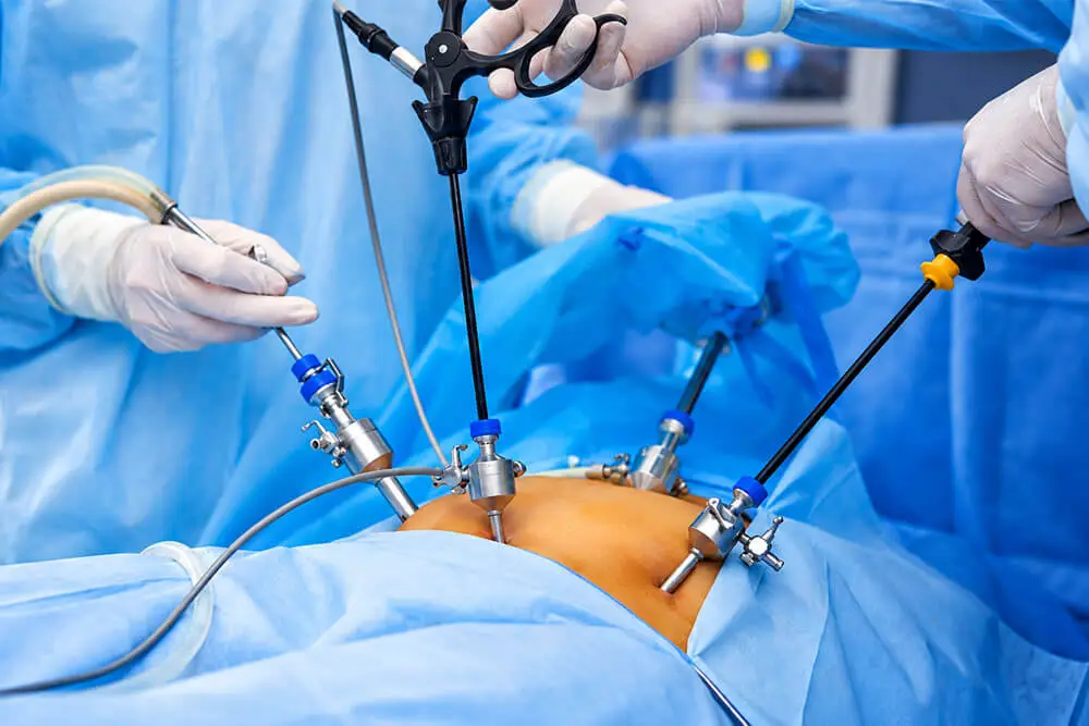 Laparoscopic Cancer Surgeon